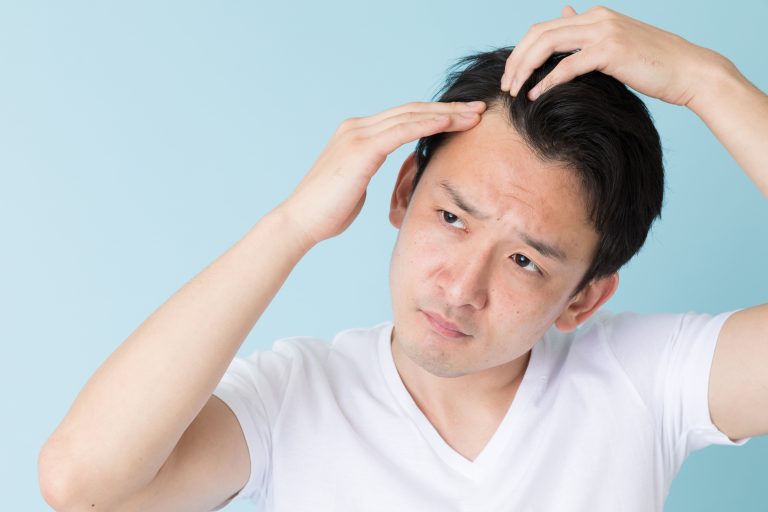 AGAの治療が現状維持になる原因はプロペシアにある