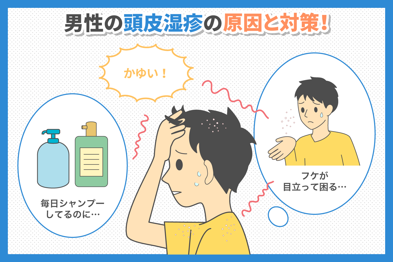 _男性の頭皮湿疹の原因と対処法について