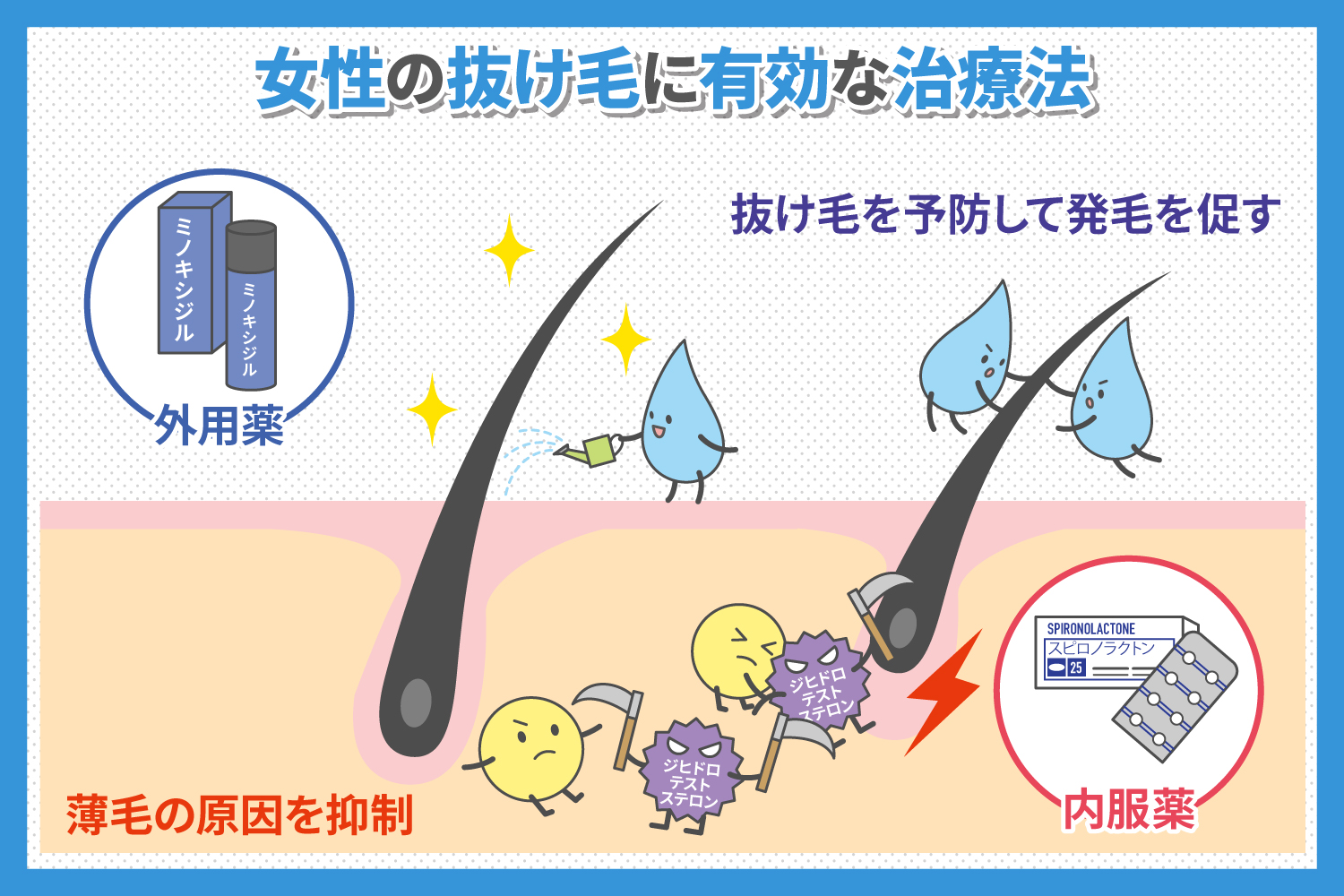 女性の抜け毛の主な治療法