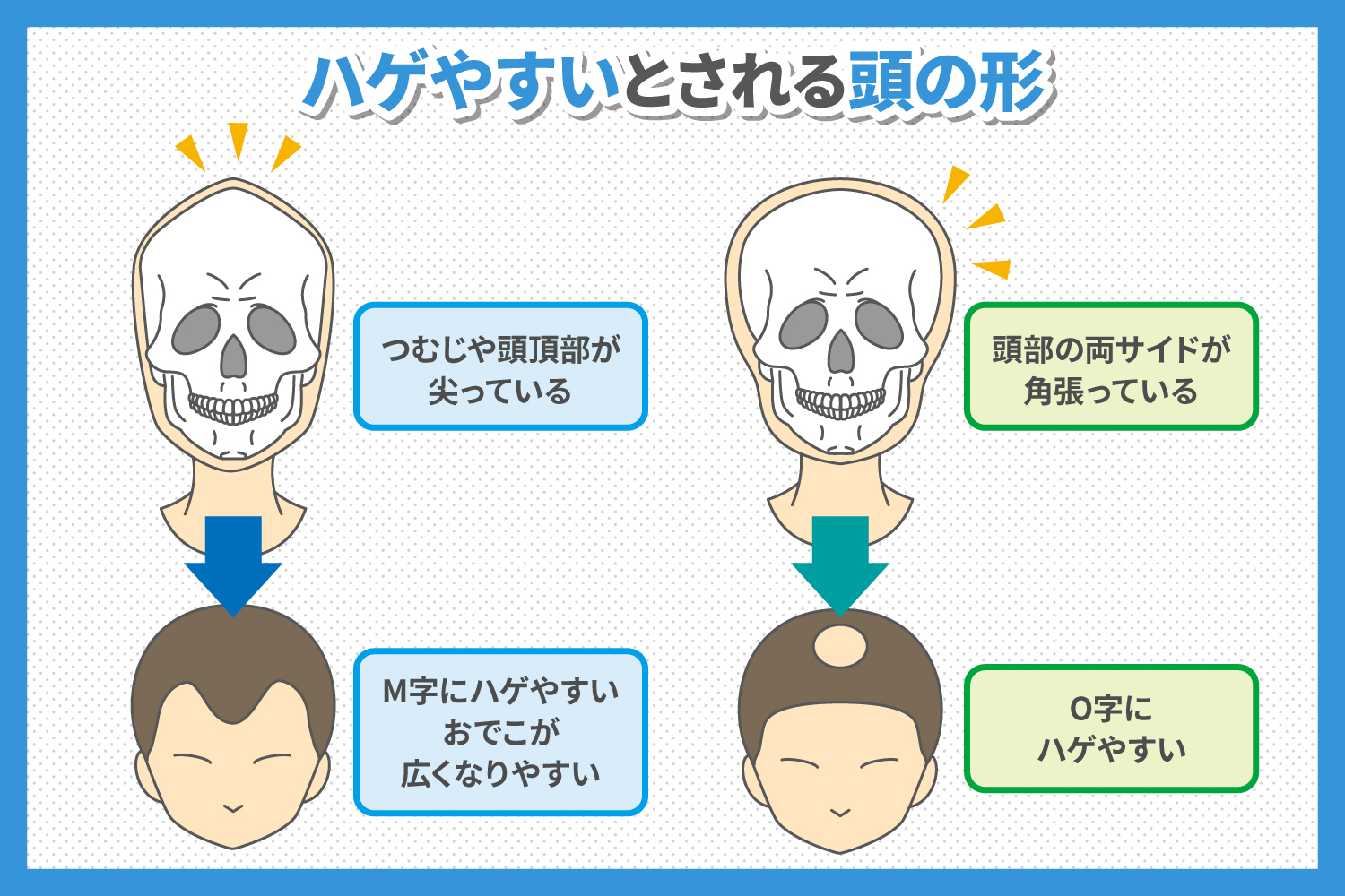 ハゲやすいとされる頭の形